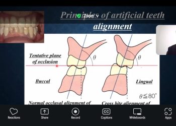 Kuliah Umum FKG Unhas dan Okayama University Bahas Kesehatan Gigi Lansia