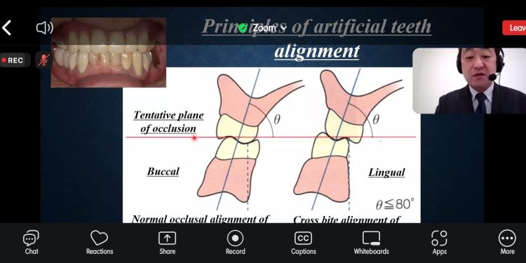 Kuliah Umum FKG Unhas dan Okayama University Bahas Kesehatan Gigi Lansia